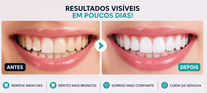 Escova Elétrica Sônica Profissional – 42.000 Vibrações | Dentes Mais Brancos em Casa + 4 Refis Grátis